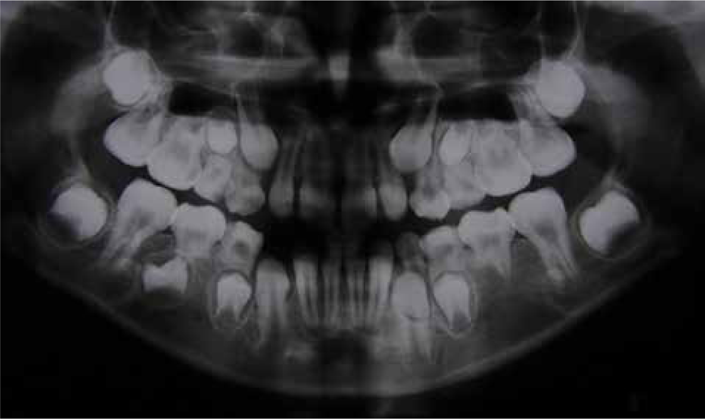otodental-sindromu