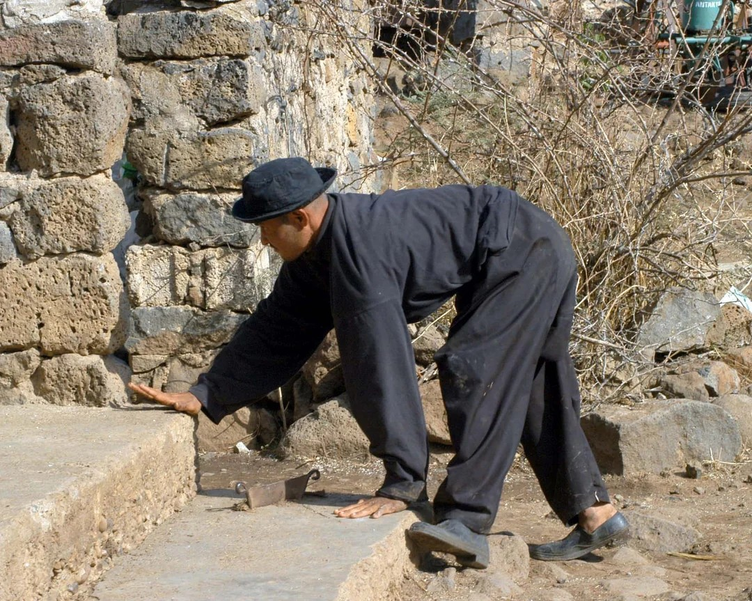 uner-tan-sindromu